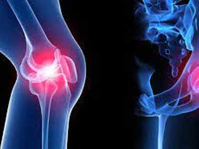 Orthopedic Oncology 